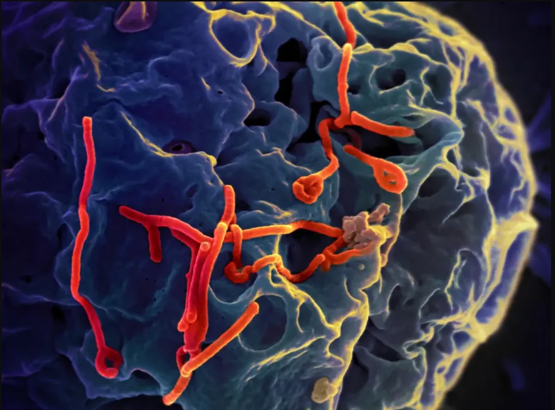 Brasil investiga caso suspeito de Ebola em São Paulo e autoridades monitoram paciente